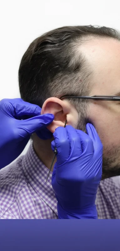 Manual ear wax removal